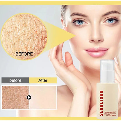 SEOUL 1988 Retinal Duo – Anti-Aging Serum + Eye Cream